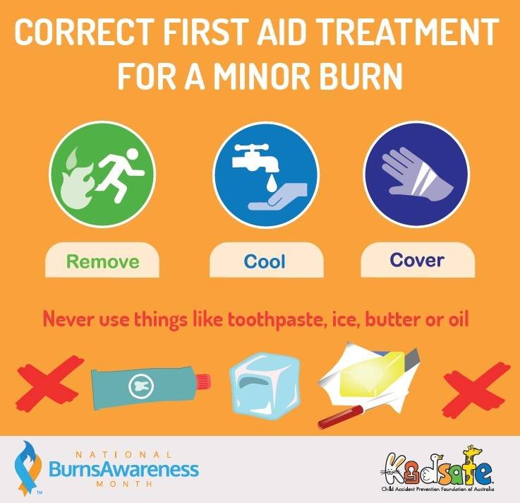 Correct First Aid Treatment for A minor Burn